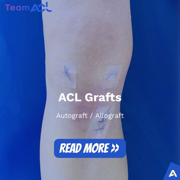 acl grafts